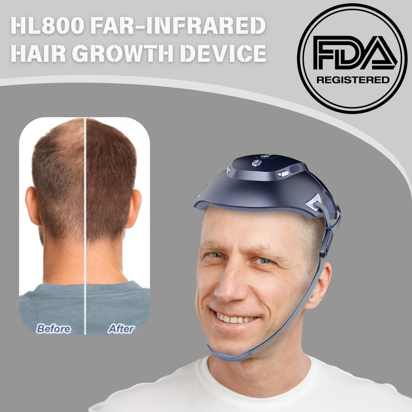 Zonn™ HL800 Graphene Far Infrared Hair Growth Cap with Massage - For Men and Women