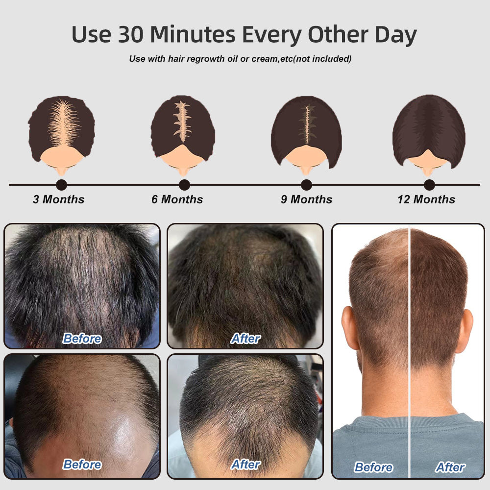 Zonn™ HL800 Graphene Far Infrared Hair Growth Cap with Massage - For Men and Women